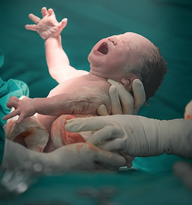 Obstetricia